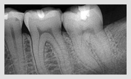 X-rays